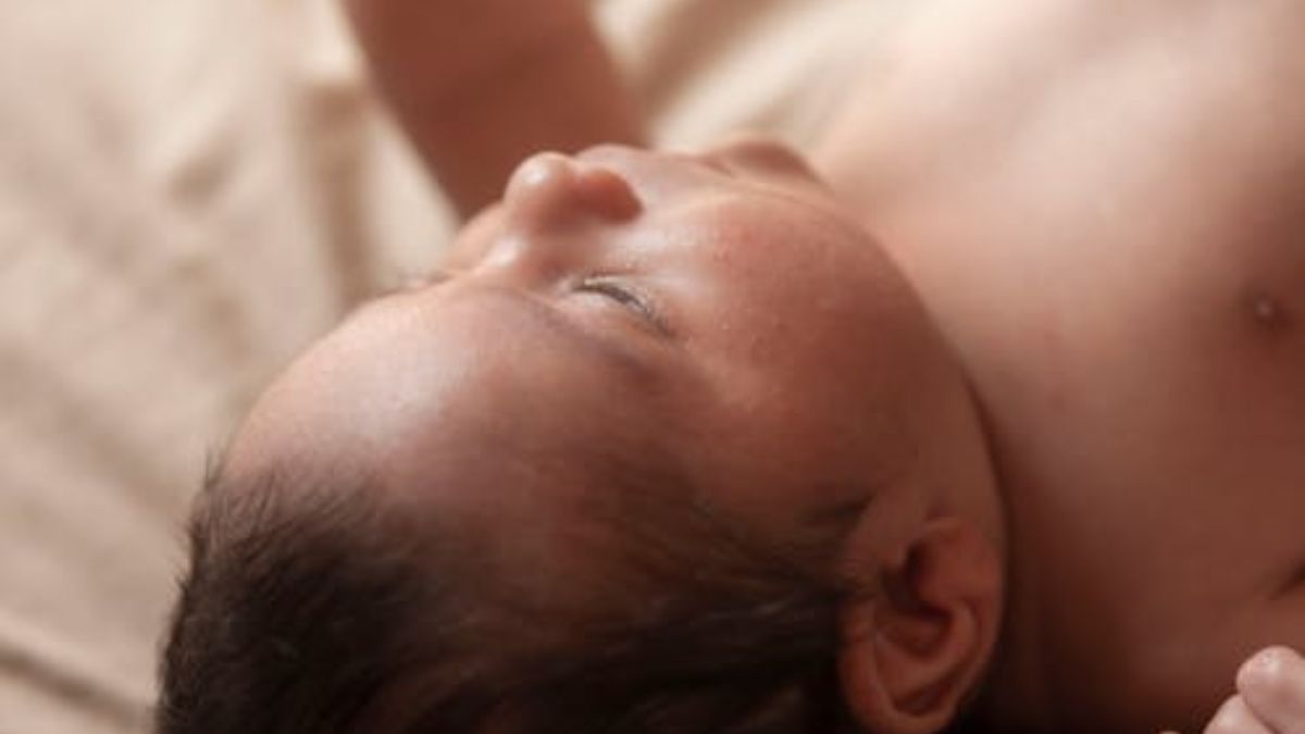 Infant born with 2 babies in abdomen: What is this rare medical condition? Infant born with 2 babies in abdomen: What is this rare medical condition?