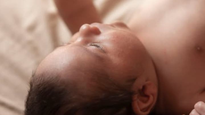 Infant born with 2 babies in abdomen: What is this rare medical condition?