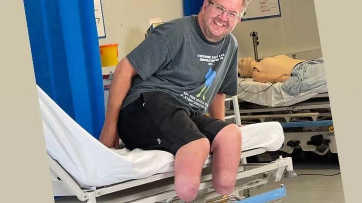 The shocking story of a British doctor who amputated his legs for sexual gratification