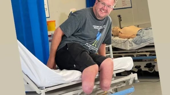 The shocking story of a British doctor who amputated his legs for sexual gratification