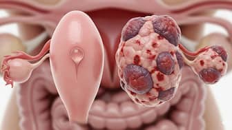 This is an AI generated image for representational purpose.
