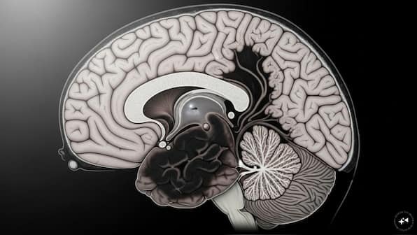Breakthrough: Scientists treat Huntington's disease for the first time