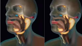 These glands could lower side effects in head and neck radiation patients. Image courtesy Instagram