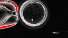 Can babies be born without a womb? Scientists make human eggs in lab
