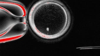 An image of an oocyte with a bright image of a skin cell nucleus before fertilisation.  Image courtesy: Oregon Health & Science University