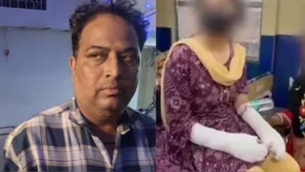Delhi’s acid attack was staged: How revenge led a DU student and her father to fake the crime