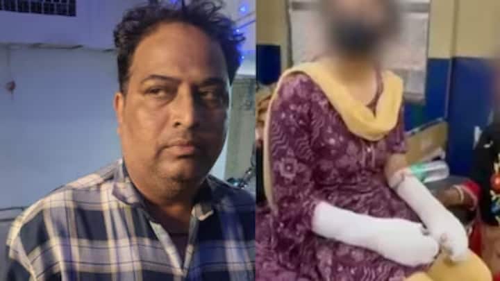 Delhi’s acid attack was staged: How revenge led a DU student and her father to fake the crime Delhi’s acid attack was staged: How revenge led a DU student and her father to fake the crime