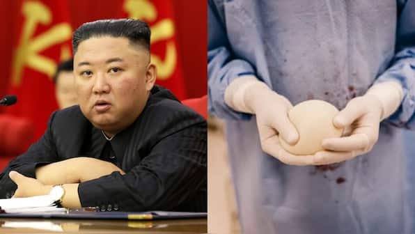No more breast implants: Why North Korea is cracking down on cosmetic surgeries