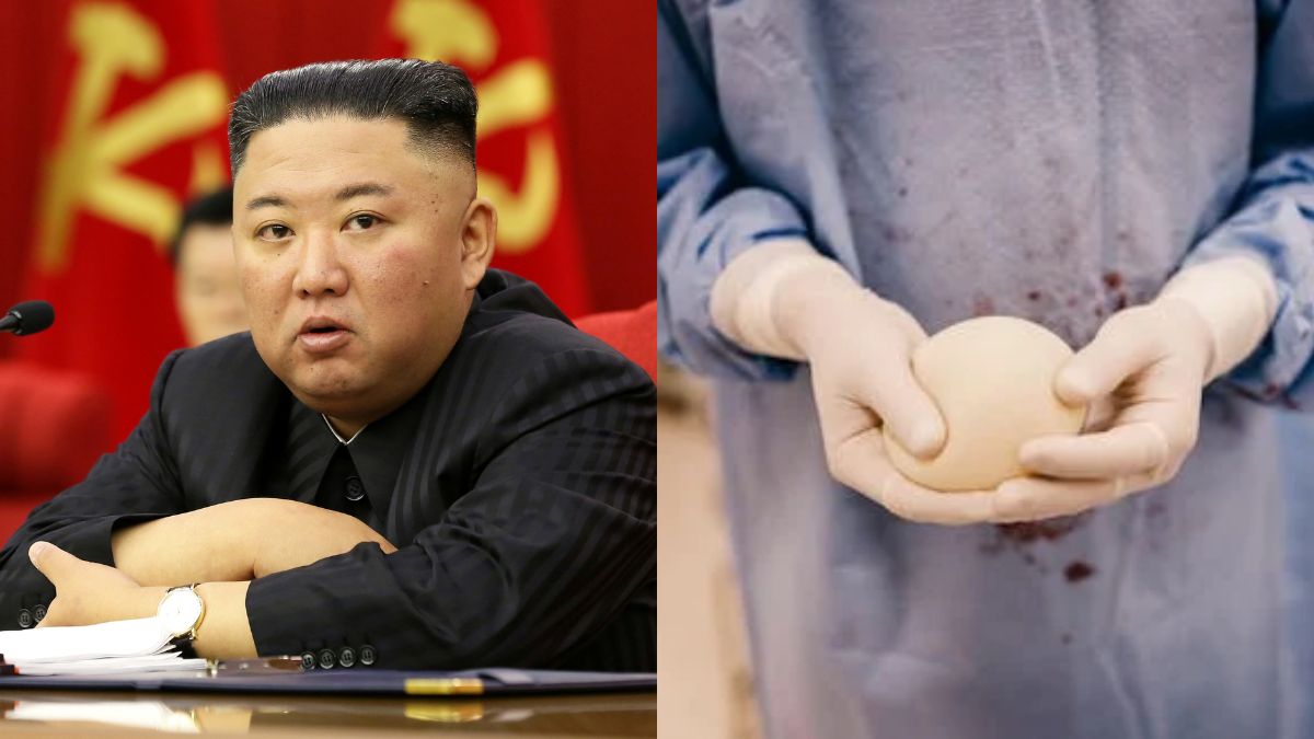 Kim Jong un has declared cosmetic surgery, especially breast enlargement procedures, as "un-socialist" and "bourgeois.” Image courtesy: Reuters, Pixabay Kim Jong un has declared cosmetic surgery, especially breast enlargement procedures, as "un-socialist" and "bourgeois.” Image courtesy: Reuters, Pixabay