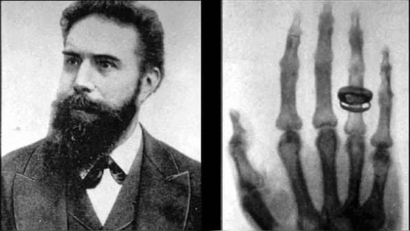 History Today: How a German scientist accidentally discovered X-rays and changed the world