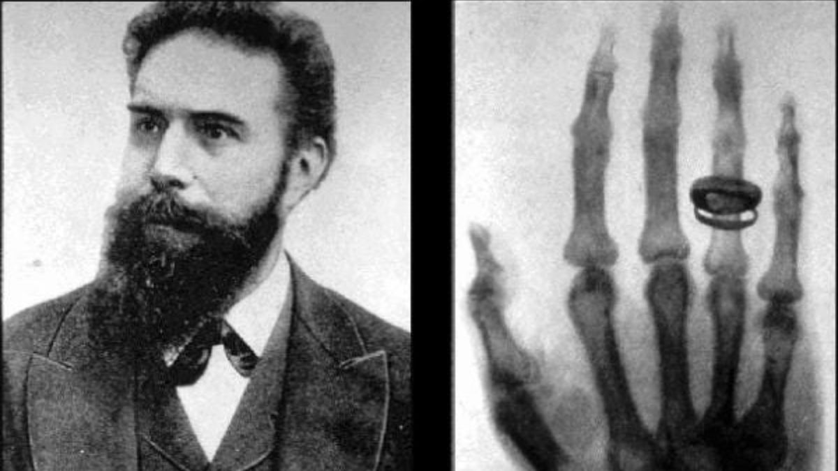 History Today: How a German scientist accidentally discovered X-rays and changed the world History Today: How a German scientist accidentally discovered X-rays and changed the world