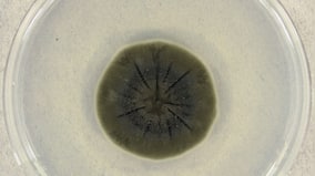 Chernobyl’s ruins, where no species dared to survive, are now home to strange radiation-powered fungi