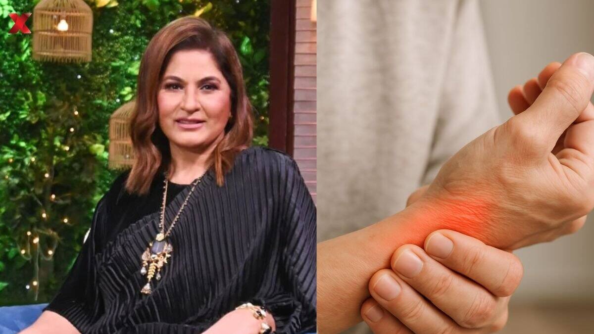 Archana Puran Singh Suffers from Complex Regional Pain Syndrome