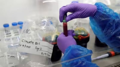 Nipah Virus: Deadly, Unpredictable Threat; Experts Urge Urgent Vigilance Amid West Bengal Scare