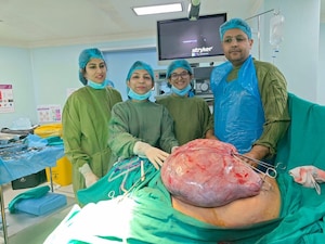 Indian hospital treats rare fibroid weighing 16 kgs, preserves 30-yr-old woman's fertility. Image: FP