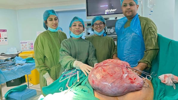 Indian hospital treats rare fibroid weighing 16 kgs, preserves 30-yr-old woman's fertility