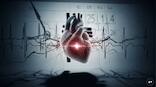 Doctor explains: How missed heart warning signs and delayed screening fuel sudden cardiac deaths