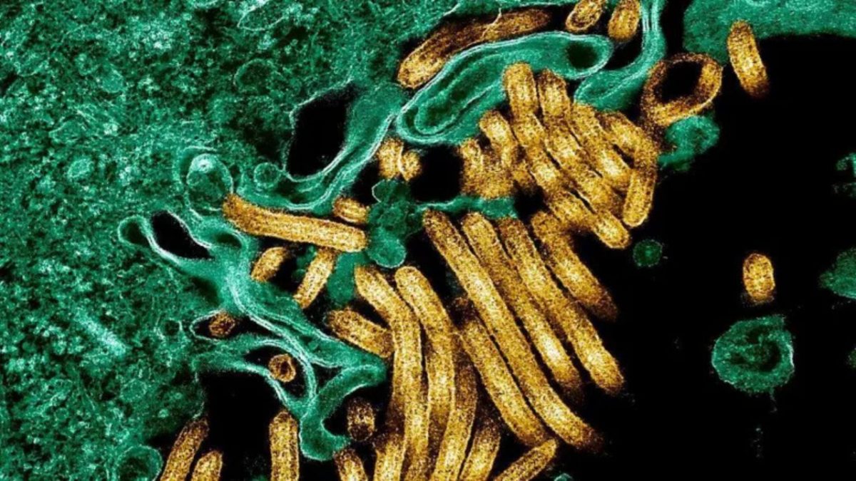 Ebola, hantavirus outbreaks show world remains unprepared for public health crisis, says pandemic expert