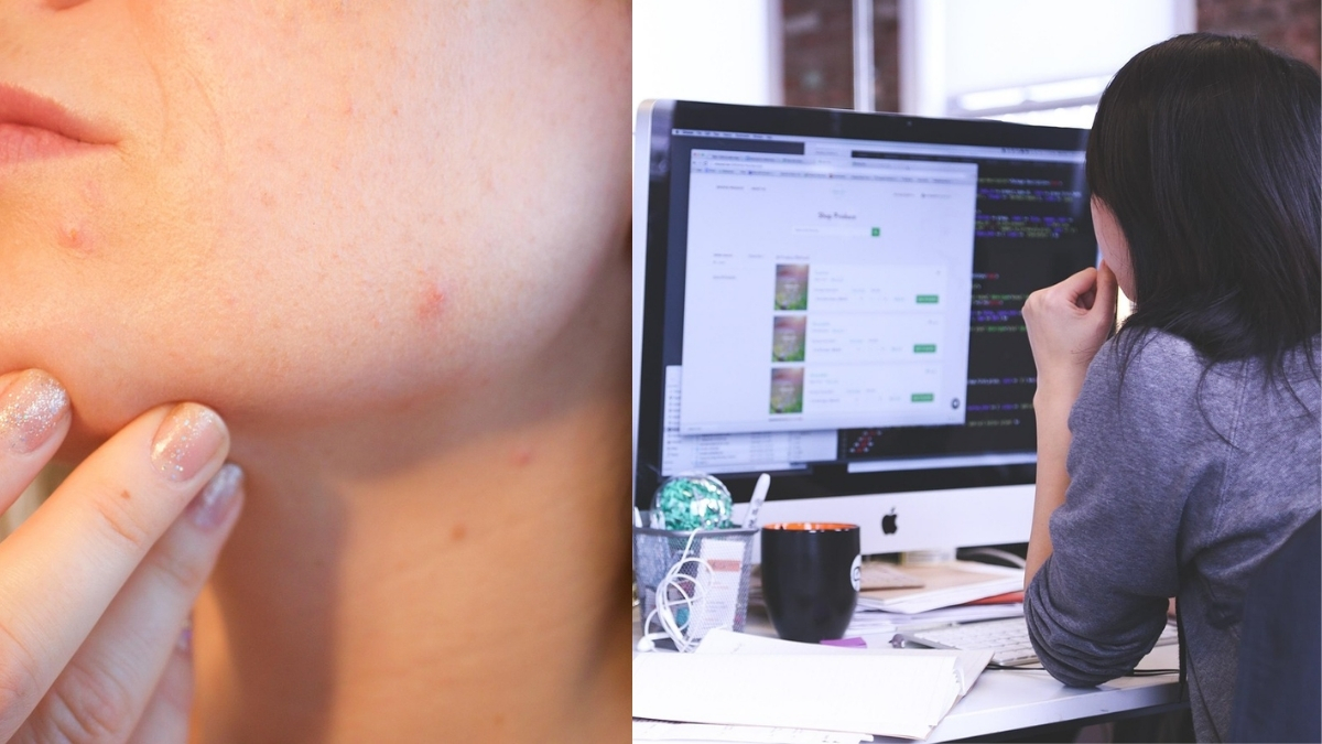 How 'office air' might be silently affecting your skin, hair and overall health How 'office air' might be silently affecting your skin, hair and overall health