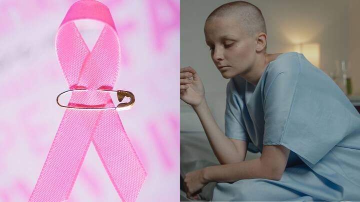 Kidney Cancer Day 2026: Oncologist reveals symptoms you must not ignore Kidney Cancer Day 2026: Oncologist reveals symptoms you must not ignore