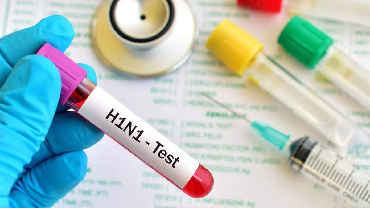 Swine Flu Cases Rise in Uttarakhand :- उत्तराखंड में Swine Flu का बढ़ता कहर, H1N1 के 49 मरीज आए सामने 5 की मौत !