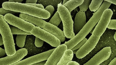 Pneumonic plague is one kind of plague that is caused by the bacteria Yersinia pestis. Symptoms can include fever, headache, weakness, breathing problems, chest pain and cough. Representational image/Pixabay