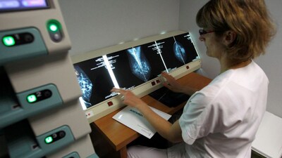Radiation therapy is commonly recommended after breast-conserving surgery. Depending on the characteristics of the cancer, chemotherapy, hormone therapy or targeted treatment may also form part of the treatment plan. Representational image- Reuters