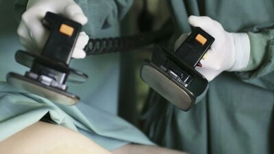 Heart Risks Emerge Early: 58.5% of Young Employees Under 35 Show Warning Signs
