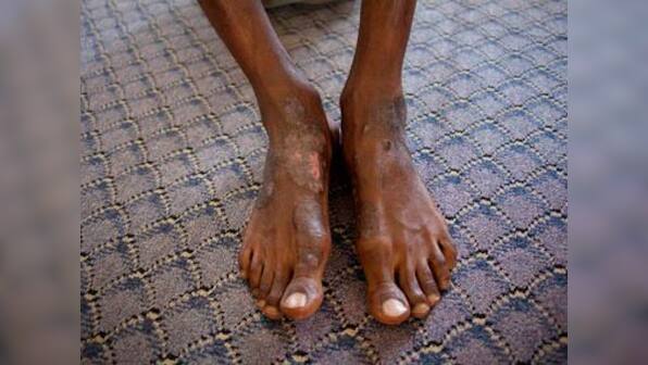 Doctors suspend work in Libya jails, protest repetitive torture