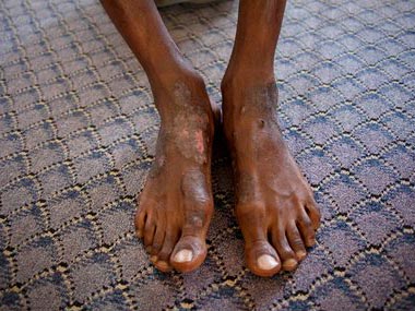 Doctors suspend work in Libya jails, protest repetitive torture Doctors suspend work in Libya jails, protest repetitive torture