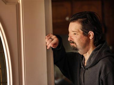 First US full face transplant patient regains ability to smile First US full face transplant patient regains ability to smile