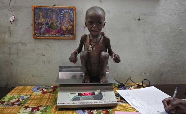 Images: A richer India with more underweight children than Sub-Saharan Africa