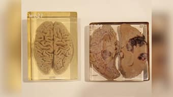 Albert Einstein's brain on display in London exhibition