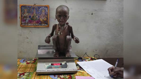 'Women empowerment can help India end malnutrition, fight anemia by 2022'