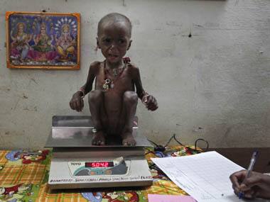 No one starves in India. The poor drink, get sick and die