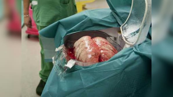 Indian scientist in team that nears taming fatal lung disease