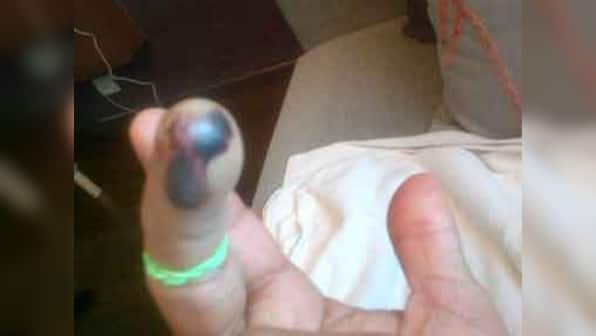 Finger still not looking good, tweets Tendulkar – Firstpost