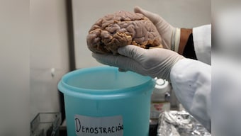 Bigger is better: Brain size affects intelligence