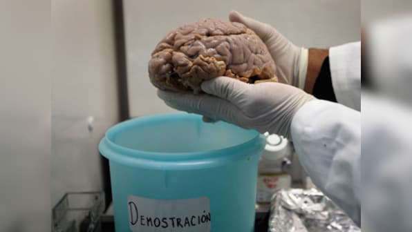 Bigger is better: Brain size affects intelligence