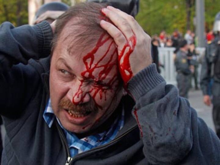 Moscow's anti-Putin protesters face arrests 