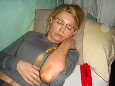 Merkel urges treatment for imprisoned Tymoshenko Merkel urges treatment for imprisoned Tymoshenko