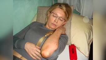 Merkel urges treatment for imprisoned Tymoshenko
