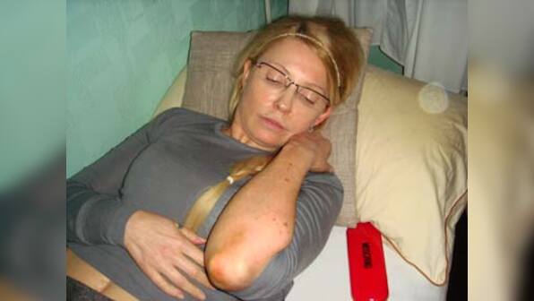 Merkel urges treatment for imprisoned Tymoshenko
