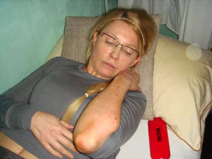 Merkel urges treatment for imprisoned Tymoshenko