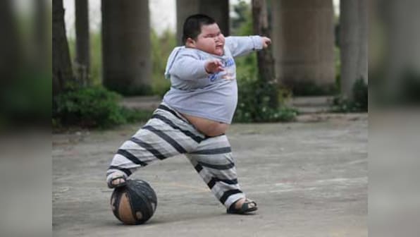 C-section may double risk of childhood obesity: study