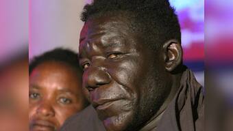 Zimbabwe's Mr Ugly: My face makes me special