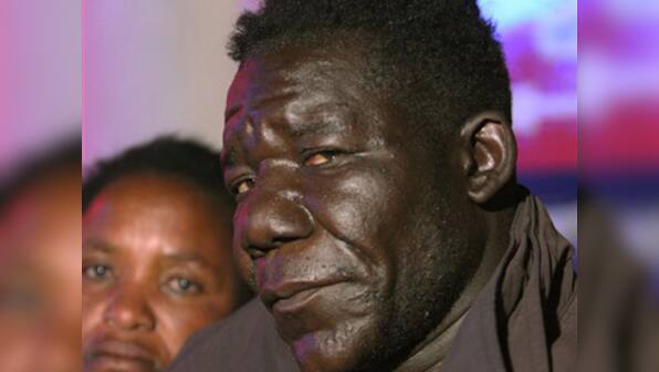 Zimbabwe's Mr Ugly: My face makes me special