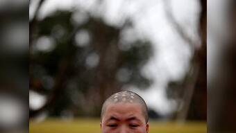 Scientists claim new baldness cure 'wakes up' hair