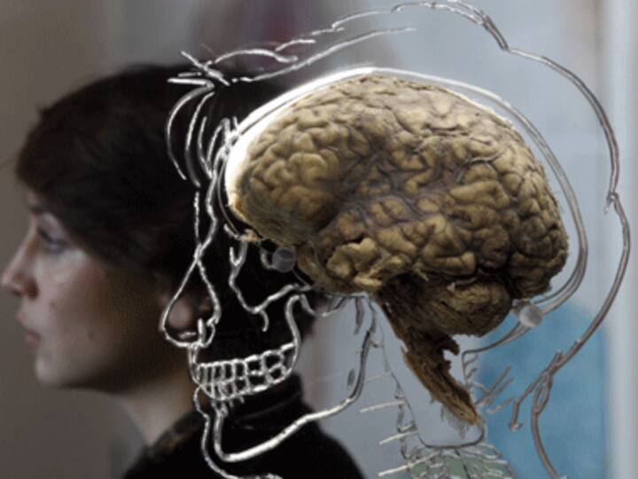 Brain imaging can tell how smart you are Brain imaging can tell how smart you are