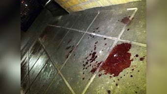  Nanoparticles can help stop bleeding fast